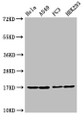Western Blot, Positive WB detected in: Hela cell acid extracts, A549 cell acid extracts, PC-3 cell acid extracts, HEK293 cell acid extracts, All lanes: HIST1H3A antibody at 1ug/ml, Secondary, Goat polyclonal to rabbit IgG at 1/50000 dilution, Predicted band size: 16 kDa, Observed band size: 16 kDa Western Blot, Positive WB detected in: Hela cell acid extracts, A549 cell acid extracts, PC-3 cell acid extracts, HEK293 cell acid extracts, All lanes: HIST1H3A antibody at 1ug/ml, Secondary, Goat polyclonal to rabbit IgG at 1/50000 dilution, Predicted band size: 16 kDa, Observed band size: 16 kDa