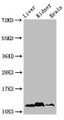 Western Blot, Positive WB detected in: Mouse liver tissue, Mouse kideny tissue, Mouse brain tissue, All lanes: HIST1H4A antibody at 1ug/ml, Secondary, Goat polyclonal to rabbit IgG at 1/50000 dilution, Predicted band size: 12 kDa, Observed band size: 12 kDa Western Blot, Positive WB detected in: Mouse liver tissue, Mouse kideny tissue, Mouse brain tissue, All lanes: HIST1H4A antibody at 1ug/ml, Secondary, Goat polyclonal to rabbit IgG at 1/50000 dilution, Predicted band size: 12 kDa, Observed band size: 12 kDa