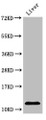 Western Blot, Positive WB detected in: Rat liver tissue, All lanes: HIST1H4A antibody at 2ug/ml, Secondary, Goat polyclonal to rabbit IgG at 1/50000 dilution, Predicted band size: 12 kDa, Observed band size: 12 kDa Western Blot, Positive WB detected in: Rat liver tissue, All lanes: HIST1H4A antibody at 2ug/ml, Secondary, Goat polyclonal to rabbit IgG at 1/50000 dilution, Predicted band size: 12 kDa, Observed band size: 12 kDa