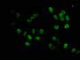 Immunofluorescent analysis of Hela cells using CAC15198 at dilution of 1:100 and Alexa Fluor 488-congugated AffiniPure Goat Anti-Rabbit IgG(H+L)