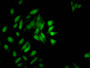 Immunofluorescent analysis of Hela cells using CAC15202 at dilution of 1:100 and Alexa Fluor 488-congugated AffiniPure Goat Anti-Rabbit IgG(H+L)