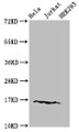 Western Blot, Positive WB detected in: Hela cell acid extracts, Jurkat cell acid extracts, HEK293 cell acid extracts, All lanes: HIST1H3A antibody at 1.5ug/ml, Secondary, Goat polyclonal to rabbit IgG at 1/50000 dilution, Predicted band size: 16 kDa, Observed band size: 16 kDa Western Blot, Positive WB detected in: Hela cell acid extracts, Jurkat cell acid extracts, HEK293 cell acid extracts, All lanes: HIST1H3A antibody at 1.5ug/ml, Secondary, Goat polyclonal to rabbit IgG at 1/50000 dilution, Predicted band size: 16 kDa, Observed band size: 16 kDa
