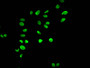 Immunofluorescent analysis of Hela cells using CAC15204 at dilution of 1:100 and Alexa Fluor 488-congugated AffiniPure Goat Anti-Rabbit IgG(H+L)