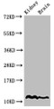 Western Blot, Positive WB detected in: Mouse kidney tissue, Mouse brain tissue, All lanes: HIST1H4A antibody at 2ug/ml, Secondary, Goat polyclonal to rabbit IgG at 1/50000 dilution, Predicted band size: 12 kDa, Observed band size: 12 kDa Western Blot, Positive WB detected in: Mouse kidney tissue, Mouse brain tissue, All lanes: HIST1H4A antibody at 2ug/ml, Secondary, Goat polyclonal to rabbit IgG at 1/50000 dilution, Predicted band size: 12 kDa, Observed band size: 12 kDa