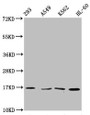 Western Blot, Positive WB detected in: 293 whole cell lysate, A549 whole cell lysate, K562 whole cell lysate, HL60 whole cell lysate, All lanes: HIST1H3A antibody at 1:500, Secondary, Goat polyclonal to rabbit IgG at 1/40000 dilution, Predicted band size: 16 kDa, Observed band size: 16 kDa Western Blot, Positive WB detected in: 293 whole cell lysate, A549 whole cell lysate, K562 whole cell lysate, HL60 whole cell lysate, All lanes: HIST1H3A antibody at 1:500, Secondary, Goat polyclonal to rabbit IgG at 1/40000 dilution, Predicted band size: 16 kDa, Observed band size: 16 kDa