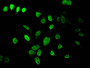 Immunofluorescent analysis of Hela cells using CAC15210 at dilution of 1:100 and Alexa Fluor 488-congugated AffiniPure Goat Anti-Rabbit IgG(H+L) Immunofluorescent analysis of Hela cells using CAC15210 at dilution of 1:100 and Alexa Fluor 488-congugated AffiniPure Goat Anti-Rabbit IgG(H+L)