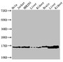 Western Blot, Positive WB detected in: Hela cell acid extracts, Jurkat cell acid extracts, HEK293 cell acid extracts, Rat liver tissue, Rat kidney tissue, Mouse brain tissue, Mouse liver tissue, Mouse kidney tissue, All lanes: HIST1H3A antibody at 1.5ug/ml, Secondary, Goat polyclonal to rabbit IgG at 1/50000 dilution, Predicted band size: 16 kDa, Observed band size: 16 kDa