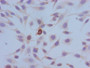 Immunocytochemistry analysis of Hela cells using CAC15215 at dilution of 1:100