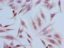 Immunocytochemistry analysis of Hela cells using CAC15224 at dilution of 1:100