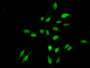 Immunofluorescent analysis of Hela cells using CAC15224 at dilution of 1:100 and Alexa Fluor 488-congugated AffiniPure Goat Anti-Rabbit IgG(H+L)