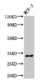 Western Blot, Positive WB detected in: MCF-7 whole cell lysate, All lanes: HIST1H1B antibody at 1ug/ml, Secondary, Goat polyclonal to rabbit IgG at 1/50000 dilution, Predicted band size: 23 kDa, Observed band size: 32 kDa