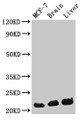 Western Blot, Positive WB detected in: MCF-7 whole cell lysate, Mouse brain tissue, Mouse liver tissue, All lanes: HIST1H1C antibody at 0.3ug/ml, Secondary, Goat polyclonal to rabbit IgG at 1/50000 dilution, Predicted band size: 22 kDa, Observed band size: 22 kDa
