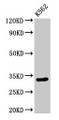 Western Blot, Positive WB detected in: K562 whole cell lysate, All lanes: HIST1H1E antibody at 0.5ug/ml, Secondary, Goat polyclonal to rabbit IgG at 1/50000 dilution, Predicted band size: 22 kDa, Observed band size: 32 kDa