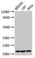 Western Blot, Positive WB detected in: HEK293 whole cell lysate, U87 whole cell lysate, K562 whole cell lysate, All lanes: HIST1H1E antibody at 1.5ug/ml, Secondary, Goat polyclonal to rabbit IgG at 1/50000 dilution, Predicted band size: 22 kDa, Observed band size: 22 kDa