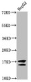 Western Blot, Positive WB detected in: HepG2 whole cell lysate (treated with 30mM sodium butyrate for 4h), All lanes: H2AFZ antibody at 1ug/ml, Secondary, Goat polyclonal to rabbit IgG at 1/50000 dilution, Predicted band size: 14 kDa, Observed band size: 14 kDa