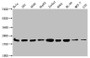 Western Blot, Positive WB detected in: Hela whole cell lysate, 293 whole cell lysate, A549 whole cell lysate, HepG2 whole cell lysate, Jurkat whole cell lysate, K562 whole cell lysate, HL60 whole cell lysate, MCF-7 whole cell lysate, LO2 whole cell lysate, All lanes: HIST1H1C antibody at 1:500, Secondary, Goat polyclonal to rabbit IgG at 1/40000 dilution, Predicted band size: 22 kDa, Observed band size: 22 kDa Western Blot, Positive WB detected in: Hela whole cell lysate, 293 whole cell lysate, A549 whole cell lysate, HepG2 whole cell lysate, Jurkat whole cell lysate, K562 whole cell lysate, HL60 whole cell lysate, MCF-7 whole cell lysate, LO2 whole cell lysate, All lanes: HIST1H1C antibody at 1:500, Secondary, Goat polyclonal to rabbit IgG at 1/40000 dilution, Predicted band size: 22 kDa, Observed band size: 22 kDa