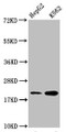 Western Blot, Positive WB detected in: HepG2 whole cell lysate, K562 whole cell lysate, All lanes: HIST1H1C antibody at 1:500, Secondary, Goat polyclonal to rabbit IgG at 1/40000 dilution, Predicted band size: 22 kDa, Observed band size: 22 kDa Western Blot, Positive WB detected in: HepG2 whole cell lysate, K562 whole cell lysate, All lanes: HIST1H1C antibody at 1:500, Secondary, Goat polyclonal to rabbit IgG at 1/40000 dilution, Predicted band size: 22 kDa, Observed band size: 22 kDa