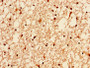 IHC image of CAC15262 diluted at 1:50 and staining in paraffin-embedded human brain tissue performed on a Leica BondTM system. After dewaxing and hydration, antigen retrieval was mediated by high pressure in a citrate buffer (pH 6.0). Section was blocked with 10% normal goat serum 30min at RT. Then primary antibody (1% BSA) was incubated at 4°C overnight. The primary is detected by a biotinylated secondary antibody and visualized using an HRP conjugated SP system.