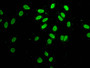 Immunofluorescence staining of Hela cells with CAC15263 at 1:25, counter-stained with DAPI. The cells were fixed in 4% formaldehyde, permeabilized using 0.2% Triton X-100 and blocked in 10% normal Goat Serum. The cells were then incubated with the antibody overnight at 4°C. The secondary antibody was Alexa Fluor 488-congugated AffiniPure Goat Anti-Rabbit IgG(H+L). Immunofluorescence staining of Hela cells with CAC15263 at 1:25, counter-stained with DAPI. The cells were fixed in 4% formaldehyde, permeabilized using 0.2% Triton X-100 and blocked in 10% normal Goat Serum. The cells were then incubated with the antibody overnight at 4°C. The secondary antibody was Alexa Fluor 488-congugated AffiniPure Goat Anti-Rabbit IgG(H+L).