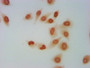 Immunocytochemistry analysis of CAC15268 diluted at 1:5 and staining in Hela cells performed on a Leica BondTM system. The cells were fixed in 4% formaldehyde, permeabilized using 0.2% Triton X-100 and blocked with 10% normal goat serum 30min at RT. Then primary antibody (1% BSA) was incubated at 4°C overnight. The primary is detected by a biotinylated secondary antibody and visualized using an HRP conjugated SP system.