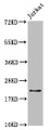 Western Blot, Positive WB detected in: Jurkat whole cell lysate, All lanes: HIST1H1C antibody at 1.7ug/ml, Secondary, Goat polyclonal to rabbit IgG at 1/50000 dilution, Predicted band size: 22 kDa, Observed band size: 22 kDa Western Blot, Positive WB detected in: Jurkat whole cell lysate, All lanes: HIST1H1C antibody at 1.7ug/ml, Secondary, Goat polyclonal to rabbit IgG at 1/50000 dilution, Predicted band size: 22 kDa, Observed band size: 22 kDa