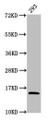 Western Blot, Positive WB detected in: 293 whole cell lysate, All lanes: HIST1H2AG antibody at 1.32ug/ml, Secondary, Goat polyclonal to rabbit IgG at 1/50000 dilution, Predicted band size: 15 kDa, Observed band size: 15 kDa Western Blot, Positive WB detected in: 293 whole cell lysate, All lanes: HIST1H2AG antibody at 1.32ug/ml, Secondary, Goat polyclonal to rabbit IgG at 1/50000 dilution, Predicted band size: 15 kDa, Observed band size: 15 kDa