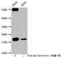 Western Blot, Detected samples: K562 whole cell lysate; Untreated (-) or treated (+) with 30mM sodium butyrate for 4h, All lanes: HIST1H1C antibody at 1:400, Secondary, Goat polyclonal to rabbit IgG at 1/50000 dilution, Predicted band size: 22 kDa, Observed band size: 22 kDa Western Blot, Detected samples: K562 whole cell lysate; Untreated (-) or treated (+) with 30mM sodium butyrate for 4h, All lanes: HIST1H1C antibody at 1:400, Secondary, Goat polyclonal to rabbit IgG at 1/50000 dilution, Predicted band size: 22 kDa, Observed band size: 22 kDa