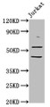 Western Blot, Positive WB detected in: Jurkat whole cell lysate, All lanes: CHRNB2 antibody at 6.05ug/ml, Secondary, Goat polyclonal to rabbit IgG at 1/50000 dilution, Predicted band size: 58 kDa, Observed band size: 58 kDa