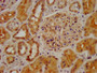 IHC image of CAC15297 diluted at 1:400 and staining in paraffin-embedded human kidney tissue performed on a Leica BondTM system. After dewaxing and hydration, antigen retrieval was mediated by high pressure in a citrate buffer (pH 6.0). Section was blocked with 10% normal goat serum 30min at RT. Then primary antibody (1% BSA) was incubated at 4°C overnight. The primary is detected by a biotinylated secondary antibody and visualized using an HRP conjugated SP system.