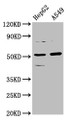 Western Blot, Positive WB detected in: HepG2 whole cell lysate, A549 whole cell lysate, All lanes: CPOX antibody at 5.7ug/ml, Secondary, Goat polyclonal to rabbit IgG at 1/50000 dilution, Predicted band size: 51, 31 kDa, Observed band size: 51 kDa