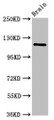 Western Blot, Positive WB detected in: Rat brain tissue, All lanes: HIP1R antibody at 2.4ug/ml, Secondary, Goat polyclonal to rabbit IgG at 1/50000 dilution, Predicted band size: 120, 71 kDa, Observed band size: 120 kDa