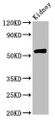 Western Blot, Positive WB detected in: Rat kidney tissue, All lanes: HMGCS2 antibody at 4.5ug/ml, Secondary, Goat polyclonal to rabbit IgG at 1/50000 dilution, Predicted band size: 57, 53, 51 kDa, Observed band size: 57 kDa