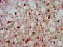 IHC image of CAC15303 diluted at 1:800 and staining in paraffin-embedded human brain tissue performed on a Leica BondTM system. After dewaxing and hydration, antigen retrieval was mediated by high pressure in a citrate buffer (pH 6.0). Section was blocked with 10% normal goat serum 30min at RT. Then primary antibody (1% BSA) was incubated at 4°C overnight. The primary is detected by a biotinylated secondary antibody and visualized using an HRP conjugated SP system.