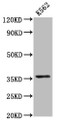 Western Blot, Positive WB detected in: K562 whole cell lysate, All lanes: PDLIM4 antibody at 6.1ug/ml, Secondary, Goat polyclonal to rabbit IgG at 1/50000 dilution, Predicted band size: 36, 26 kDa, Observed band size: 36 kDa Western Blot, Positive WB detected in: K562 whole cell lysate, All lanes: PDLIM4 antibody at 6.1ug/ml, Secondary, Goat polyclonal to rabbit IgG at 1/50000 dilution, Predicted band size: 36, 26 kDa, Observed band size: 36 kDa