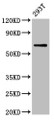 Western Blot, Positive WB detected in: 293T whole cell lysate, All lanes: ARSH antibody at 5.2ug/ml, Secondary, Goat polyclonal to rabbit IgG at 1/50000 dilution, Predicted band size: 64 kDa, Observed band size: 64 kDa