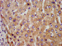 IHC image of CAC15328 diluted at 1:300 and staining in paraffin-embedded human liver tissue performed on a Leica BondTM system. After dewaxing and hydration, antigen retrieval was mediated by high pressure in a citrate buffer (pH 6.0). Section was blocked with 10% normal goat serum 30min at RT. Then primary antibody (1% BSA) was incubated at 4°C overnight. The primary is detected by a biotinylated secondary antibody and visualized using an HRP conjugated SP system.
