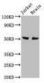Western Blot, Positive WB detected in: Jurkat whole cell lysate, Rat brain tissue, All lanes: ONECUT1 antibody at 7.6ug/ml, Secondary, Goat polyclonal to rabbit IgG at 1/50000 dilution, Predicted band size: 52 kDa, Observed band size: 52 kDa