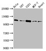Western Blot, Positive WB detected in: Hela whole cell lysate, U87 whole cell lysate, U251 whole cell lysate, MCF-7 whole cell lysate, Rat heart tissue, All lanes: ANO2 antibody at 3.9ug/ml, Secondary, Goat polyclonal to rabbit IgG at 1/50000 dilution, Predicted band size: 114 kDa, Observed band size: 114 kDa