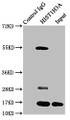 Immunoprecipitating HIST1H3A in HepG2 whole cell lysate (treated with 30mM sodium butyrate for 4h), Lane 1: Rabbit control IgG instead of CAC15339 in HepG2 whole cell lysate (treated with 30mM sodium butyrate for 4h). For western blotting, a HRP-conjugated Protein G antibody was used as the secondary antibody (1/2000), Lane 2: CAC15339 (5ug) + HepG2 whole cell lysate (treated with 30mM sodium butyrate for 4h) (500ug), Lane 3: HepG2 whole cell lysate (treated with 30mM sodium butyrate for 4h) (20ug) Immunoprecipitating HIST1H3A in HepG2 whole cell lysate (treated with 30mM sodium butyrate for 4h), Lane 1: Rabbit control IgG instead of CAC15339 in HepG2 whole cell lysate (treated with 30mM sodium butyrate for 4h). For western blotting, a HRP-conjugated Protein G antibody was used as the secondary antibody (1/2000), Lane 2: CAC15339 (5ug) + HepG2 whole cell lysate (treated with 30mM sodium butyrate for 4h) (500ug), Lane 3: HepG2 whole cell lysate (treated with 30mM sodium butyrate for 4h) (20ug)
