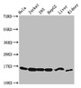 Western Blot, Positive WB detected in: Hela whole cell lysate, Jurkat whole cell lysate, 293 whole cell lysate, HepG2 whole cell lysate, Mouse liver tissue, Mouse kidney tissue, All lanes: HIST1H3A antibody at 2.48ug/ml, Secondary, Goat polyclonal to rabbit IgG at 1/50000 dilution, Predicted band size: 16 kDa, Observed band size: 16 kDa Western Blot, Positive WB detected in: Hela whole cell lysate, Jurkat whole cell lysate, 293 whole cell lysate, HepG2 whole cell lysate, Mouse liver tissue, Mouse kidney tissue, All lanes: HIST1H3A antibody at 2.48ug/ml, Secondary, Goat polyclonal to rabbit IgG at 1/50000 dilution, Predicted band size: 16 kDa, Observed band size: 16 kDa