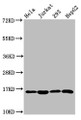 Western Blot, Positive WB detected in: Hela whole cell lysate, Jurkat whole cell lysate, 293 whole cell lysate, HepG2 whole cell lysate, All lanes: HIST1H3A antibody at 1.38ug/ml, Secondary, Goat polyclonal to rabbit IgG at 1/50000 dilution, Predicted band size: 16 kDa, Observed band size: 16 kDa
