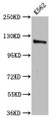 Western Blot, Positive WB detected in: K562 whole cell lysate, All lanes: CENPJ antibody at 3.2ug/ml, Secondary, Goat polyclonal to rabbit IgG at 1/50000 dilution, Predicted band size: 154, 125 kDa, Observed band size: 125 kDa Western Blot, Positive WB detected in: K562 whole cell lysate, All lanes: CENPJ antibody at 3.2ug/ml, Secondary, Goat polyclonal to rabbit IgG at 1/50000 dilution, Predicted band size: 154, 125 kDa, Observed band size: 125 kDa