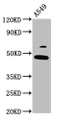 Western Blot, Positive WB detected in: A549 whole cell lysate, All lanes: FOXL2 antibody at 3.7ug/ml, Secondary, Goat polyclonal to rabbit IgG at 1/50000 dilution, Predicted band size: 39 kDa, Observed band size: 49 kDa
