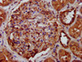 IHC image of CAC15364 diluted at 1:400 and staining in paraffin-embedded human kidney tissue performed on a Leica BondTM system. After dewaxing and hydration, antigen retrieval was mediated by high pressure in a citrate buffer (pH 6.0). Section was blocked with 10% normal goat serum 30min at RT. Then primary antibody (1% BSA) was incubated at 4°C overnight. The primary is detected by a biotinylated secondary antibody and visualized using an HRP conjugated SP system.
