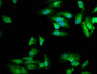 Immunofluorescence staining of Hela cells with CAC15366 at 1:100, counter-stained with DAPI. The cells were fixed in 4% formaldehyde, permeabilized using 0.2% Triton X-100 and blocked in 10% normal Goat Serum. The cells were then incubated with the antibody overnight at 4°C. The secondary antibody was Alexa Fluor 488-congugated AffiniPure Goat Anti-Rabbit IgG(H+L).