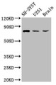 Western Blot, Positive WB detected in: SH-SY5Y whole cell lysate, U251 whole cell lysate, Rat brain tissue, All lanes: NCDN antibody at 2.6ug/ml, Secondary, Goat polyclonal to rabbit IgG at 1/50000 dilution, Predicted band size: 79, 78, 80 kDa, Observed band size: 79 kDa