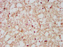 IHC image of CAC15367 diluted at 1:500 and staining in paraffin-embedded human brain tissue performed on a Leica BondTM system. After dewaxing and hydration, antigen retrieval was mediated by high pressure in a citrate buffer (pH 6.0). Section was blocked with 10% normal goat serum 30min at RT. Then primary antibody (1% BSA) was incubated at 4°C overnight. The primary is detected by a biotinylated secondary antibody and visualized using an HRP conjugated SP system.