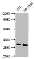 Western Blot, Positive WB detected in: 293T whole cell lysate, SH-SY5Y whole cell lysate, All lanes: RFXANK antibody at 6.7ug/ml, Secondary, Goat polyclonal to rabbit IgG at 1/50000 dilution, Predicted band size: 29, 25, 26 kDa, Observed band size: 29 kDa