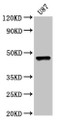 Western BlotPositive WB detected in: U87 whole cell lysateAll lanes: SOX8 antibody at 5ug/mlSecondaryGoat polyclonal to rabbit IgG at 1/50000 dilutionPredicted band size: 48 kDaObserved band size: 48 kDa