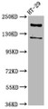 Western Blot, Positive WB detected in: HT29 whole cell lysate, All lanes: SYNJ1 antibody at 3.7ug/ml, Secondary, Goat polyclonal to rabbit IgG at 1/50000 dilution, Predicted band size: 174, 145, 144, 59 kDa, Observed band size: 174 kDa